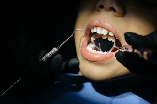 image of a kid's teeth during a dental examination