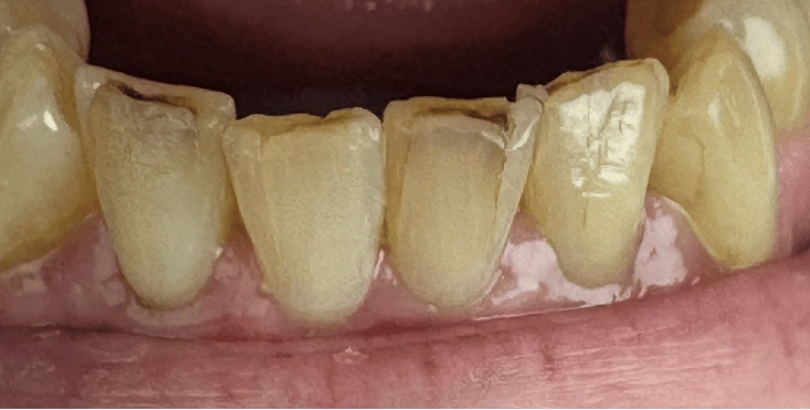 before and after (1)