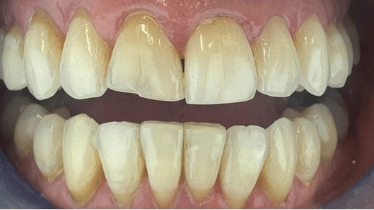 pt 5 before
