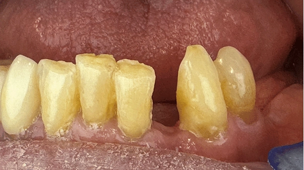 pt 6 before